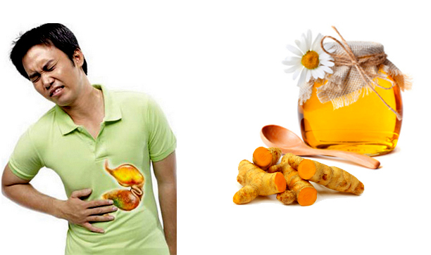 Image result for nghệ dạ dày