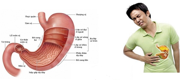 Đau bụng do bị ung thư dạ dày