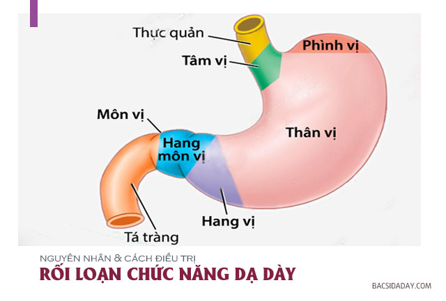 Rối loạn chức năng dạ dày