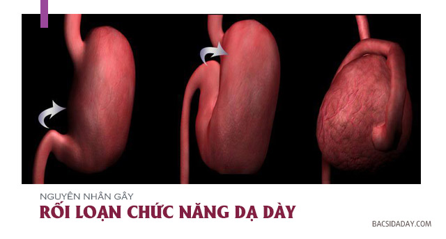 Nguyên nhân gây rối loạn chức năng dạ dày