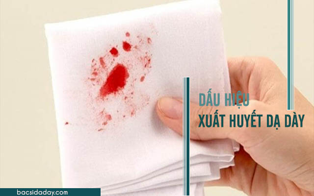 dấu hiệu xuất huyết dạ dày