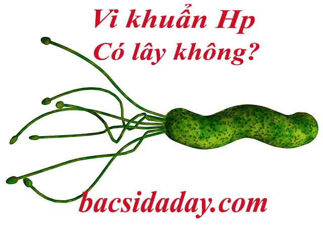 Vi khuẩn Hp có lây không?