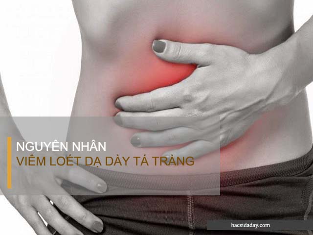 nguyên nhân viêm dạ dày tá tràng