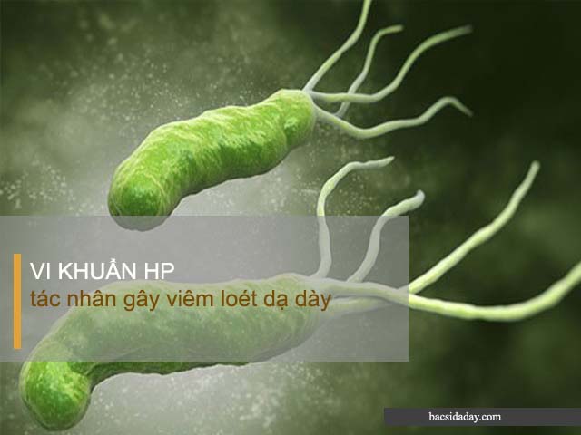 vi khuẩn Hp gây viêm loét dạ dày