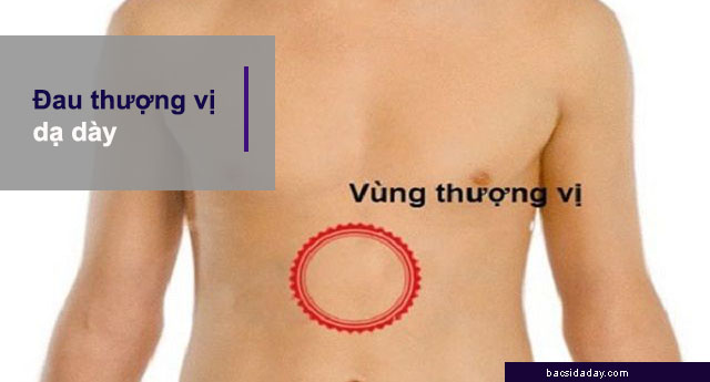 triệu chứng đau thượng vị dạ dày