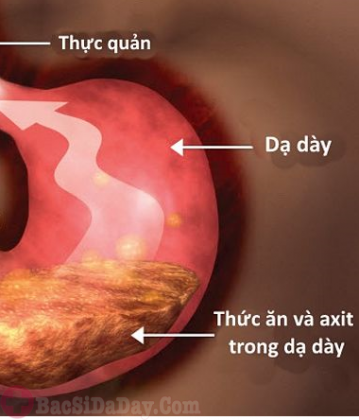 Chức năng tiêu hóa thức ăn của dạ dày