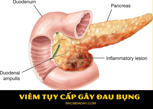 bị đau dụng là do đâu