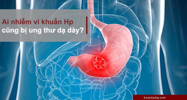 vi khuẩn hp có gây ung thư không