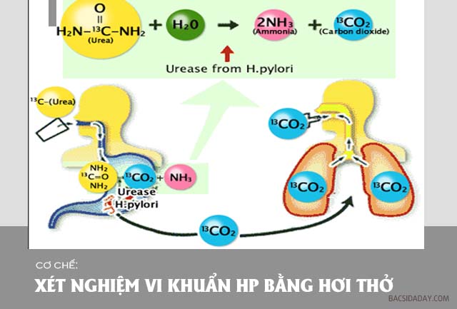 test vi khuẩn Hp bằng hơi thở