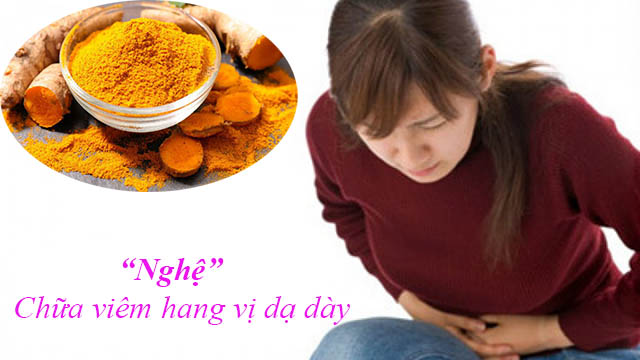 Chữa viêm hang vị dạ dày bằng nghệ