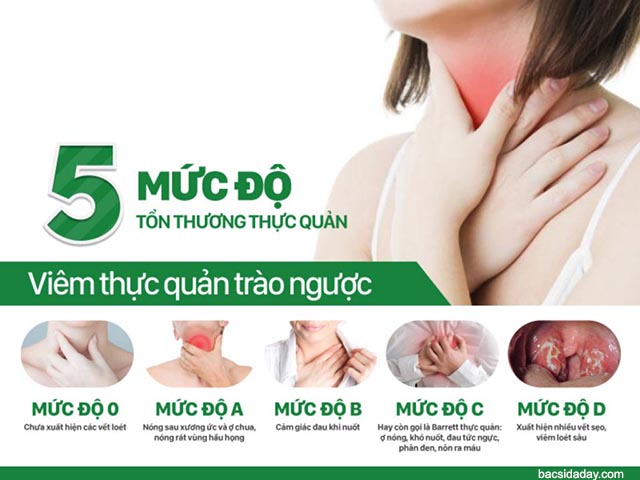 viêm trào ngược thực quản độ a