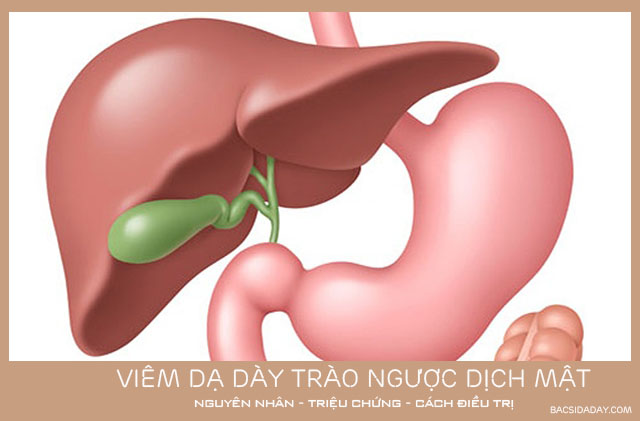 Bệnh viêm dạ dày trào ngược dịch mật