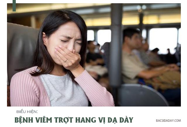 Bệnh viêm trợt hang vị dạ dày