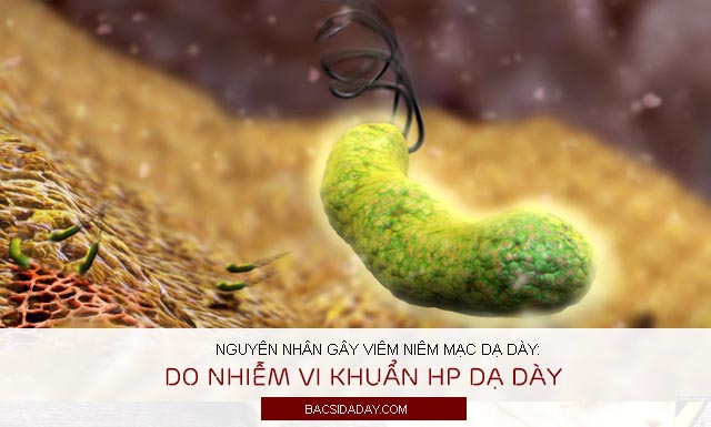 nguyên nhân viêm niêm mạc dạ dày