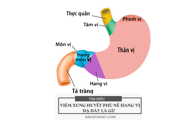 viêm hang vị dạ dày phù nề xung huyết